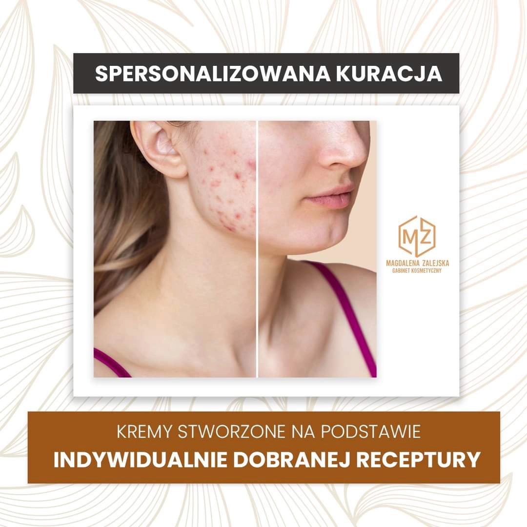 przed i po - kosmetologia